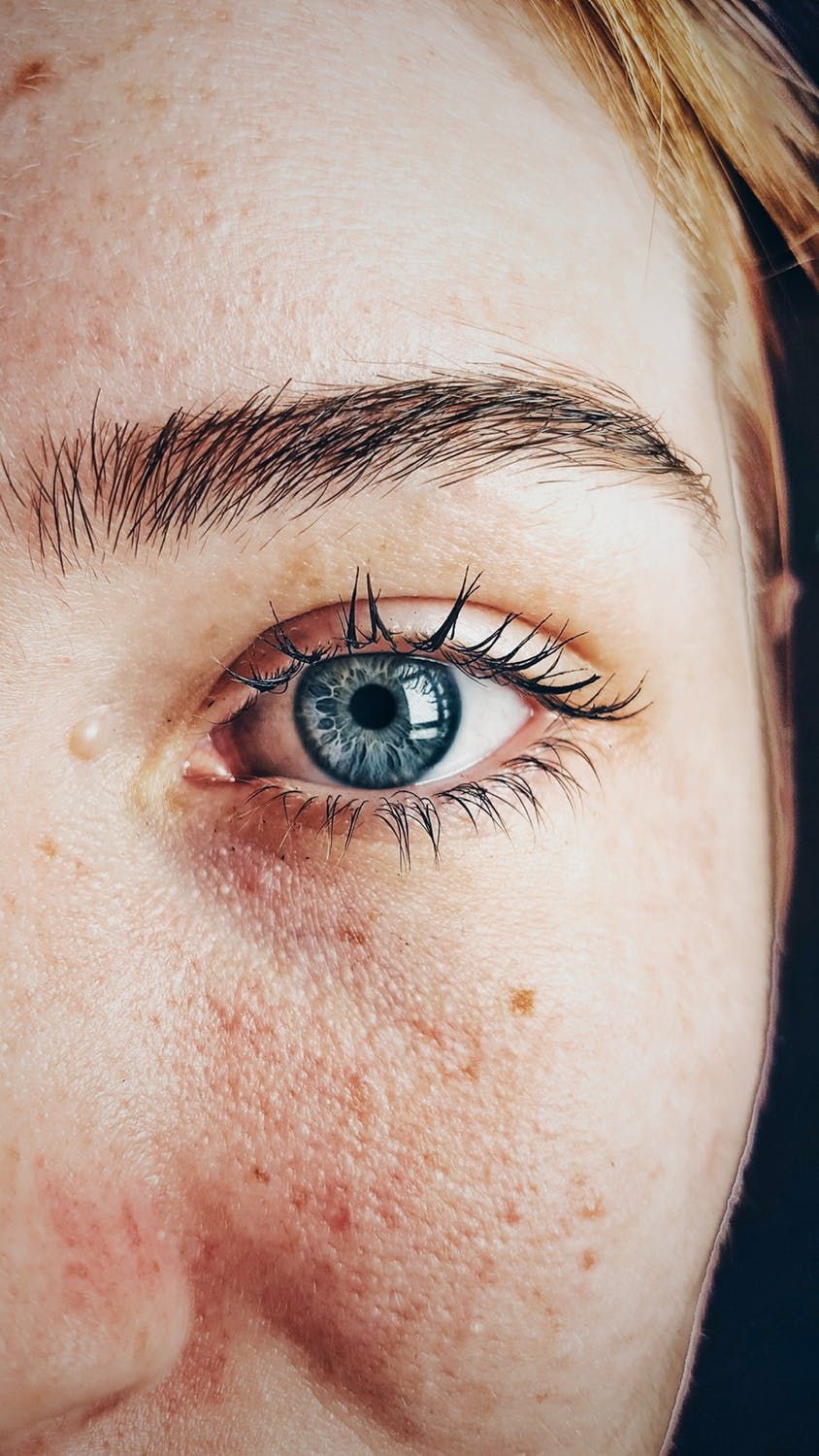 Czy warto zastosować u siebie laserową korekcję wzroku?